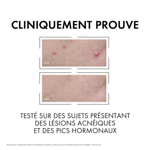 Vichy Normaderm Sérum Anti-imperfections PROBIO-BHA. Peau Grasse Acnéique | 30ml – Image 7