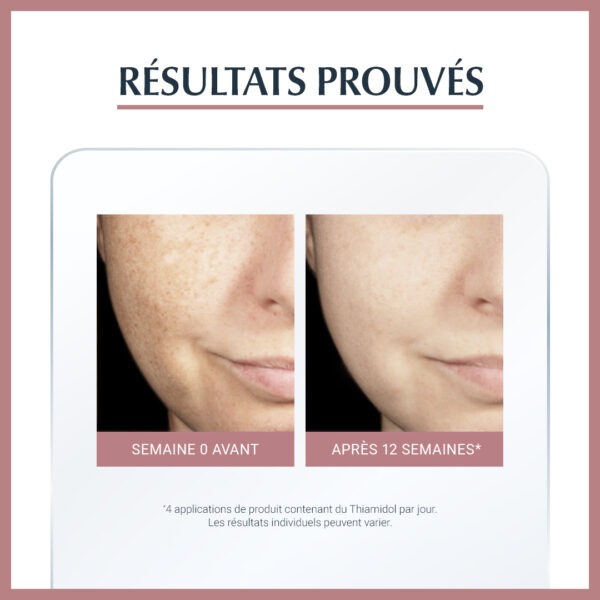 Eucerin Anti-Pigment Serum Duo 30ml + Ecran Pigment spf50+ Pack – Image 4