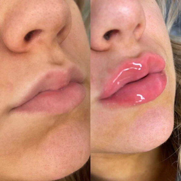 VOLULIPS Plumper Repulpant Lèvres – Image 3